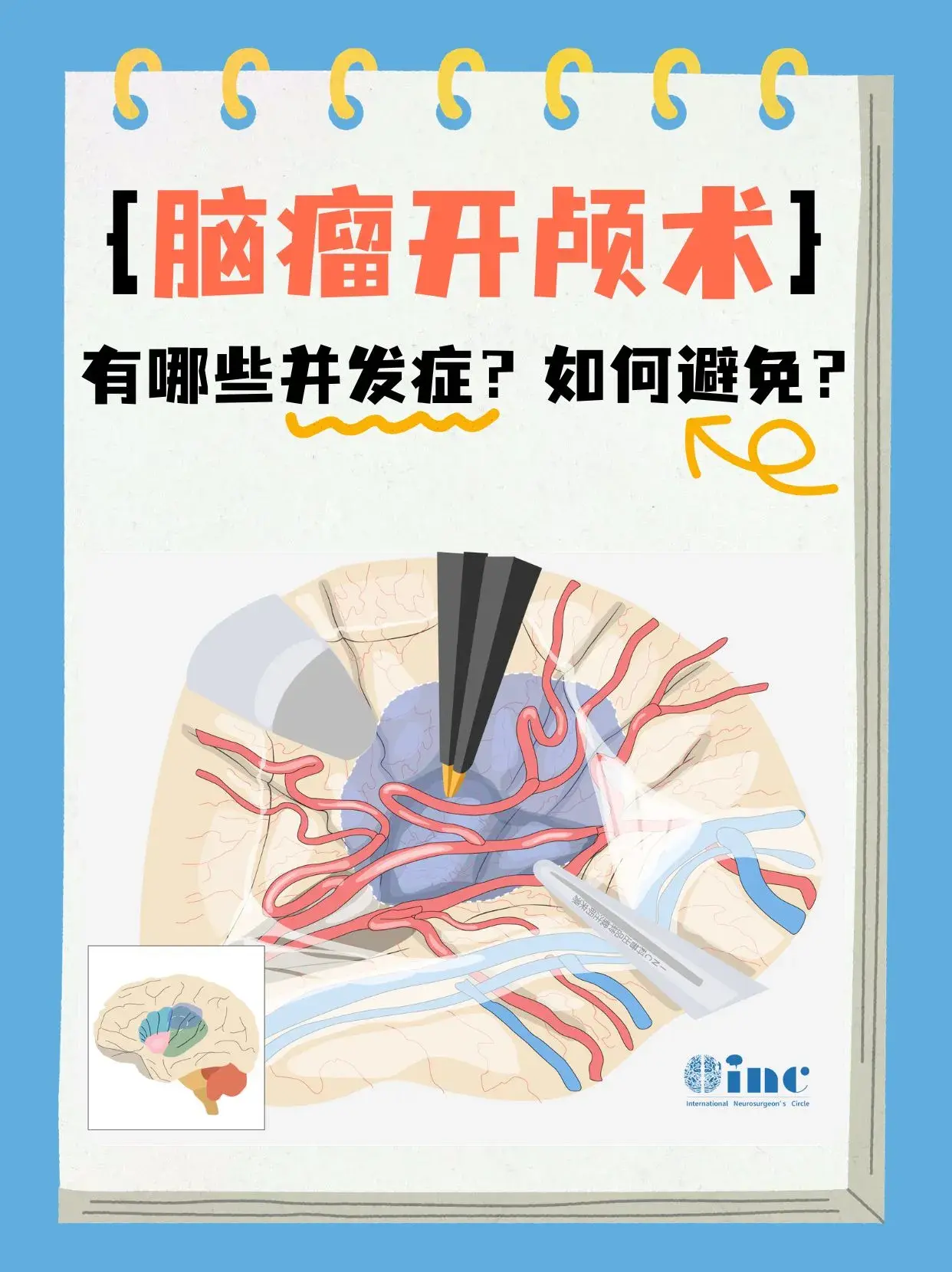 脑瘤开颅手术并发症