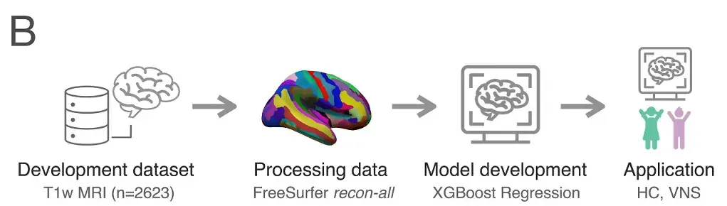 Development dataset T1w MRI(n=2623) Processing data FreeSurfer recon-all Model development XGBoost Regression Application HC, VNS