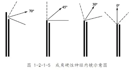 其中0°、30°、45°镜头可以用于观察和手术操作；70°和120°的镜头，手术操作困难，主要用于术野死角的观察。