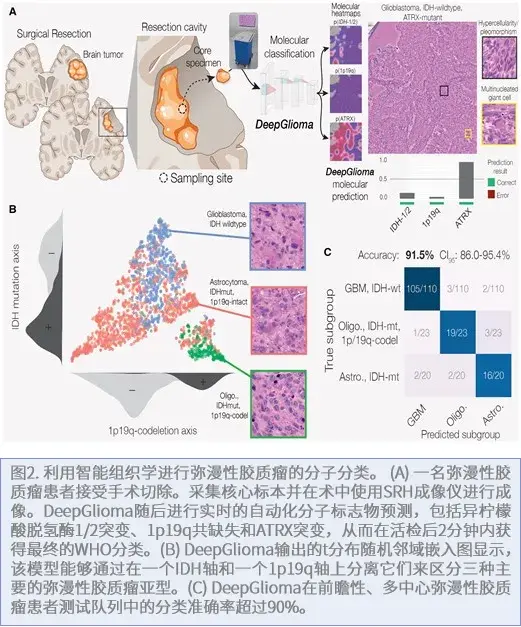 传统的术中病理学不提供分子数据。智能组织学有潜力从SRH图像预测分子标志物，为手术目标提供信息。