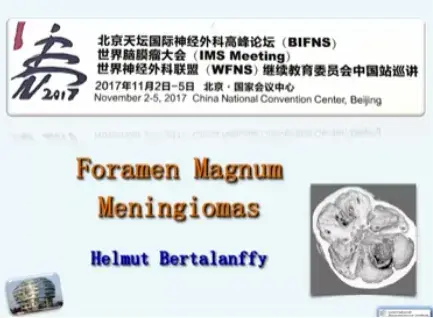 INC巴特朗菲教授精彩演讲：枕骨大孔区脑膜瘤手术策略和成功案例解析