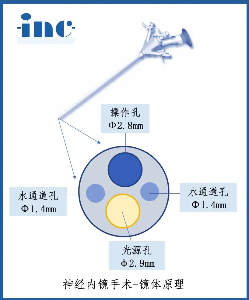 双镜联合