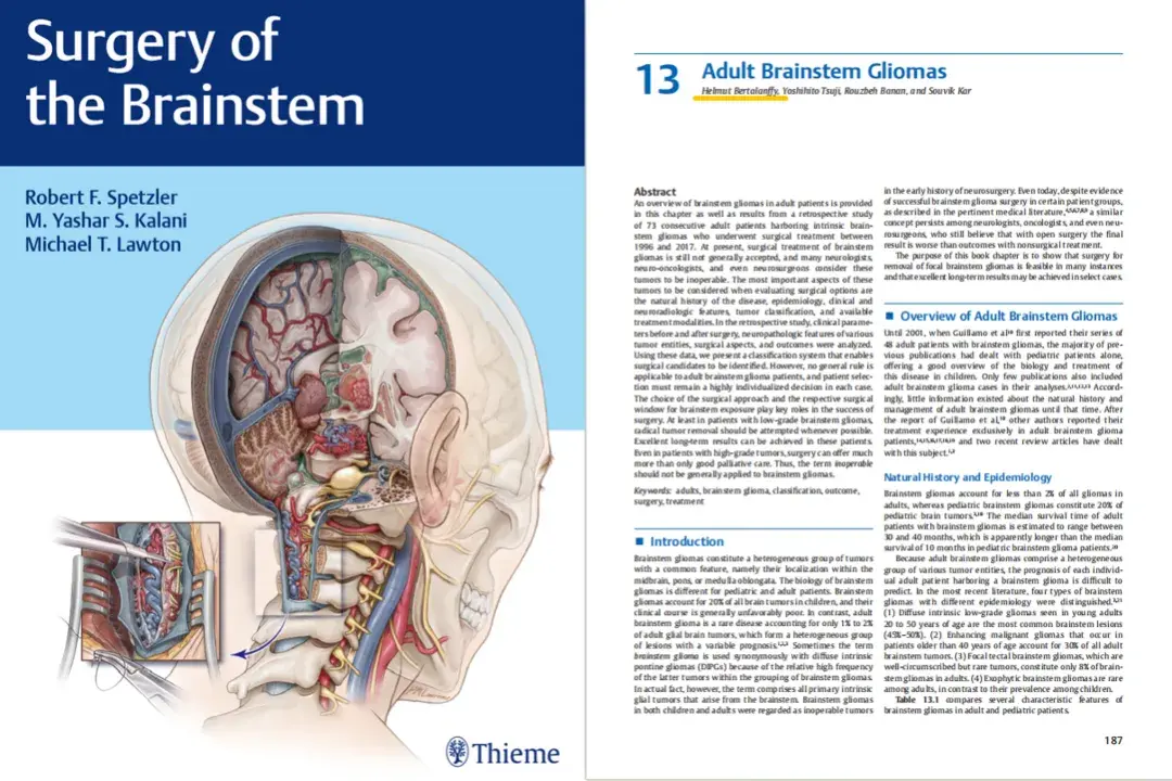 2020年的脑干肿瘤手术经典专著《Surgery of the Brainstem》中第13章Adult Brainstem Gliomas（成人脑干胶质瘤）。